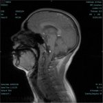 Klicken zum Vergrößern