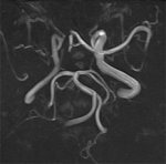 Klicken zum Vergrößern